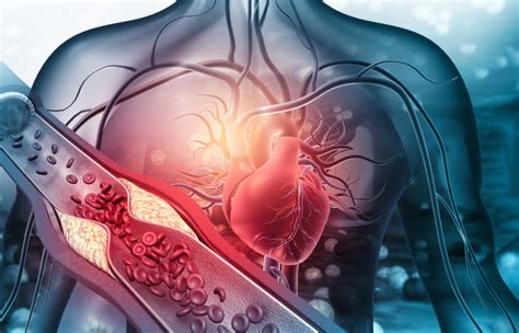 Artificial Intelligence Could Help Detect Onset Of Cardiovascular Disease