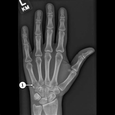 X Ray Hand Drawing