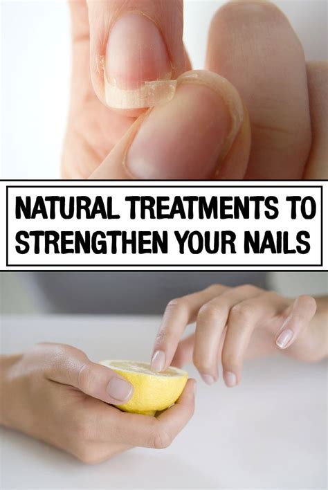 Natural Treatments To Strengthen Your Nails Womenbelle Nail