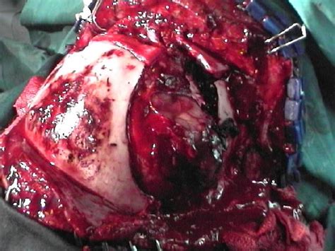 Infermieri di Neurochirurgia