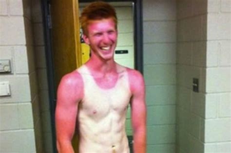 22 People Living With The Worlds Most Awkward Sun Tan Line Fails Ever
