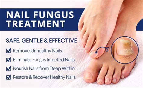 Natures Remedy Fungi Remover — Safe Kill Nail Fungus And Solution By