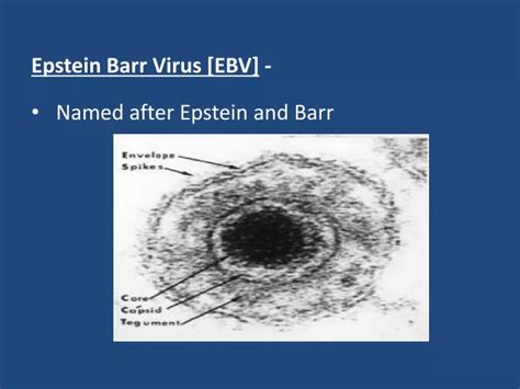 Ppt Epstein Barr Virus Ebv Named After Epstein And Barr