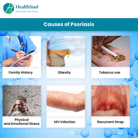Psoriasis Causes Symptoms Diagnosis Treatment Healthsoul
