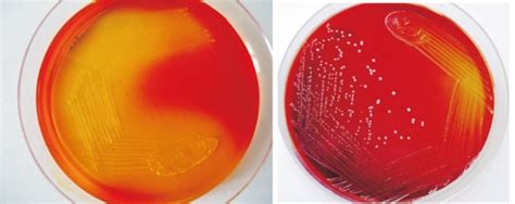 S Aureus And E Faecalis Colonies Obtained By Culturing Them On