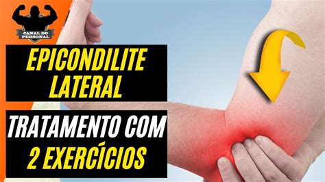 Epicondilite Lateral do Cotovelo Tratamento com 2 Exercícios YouTube