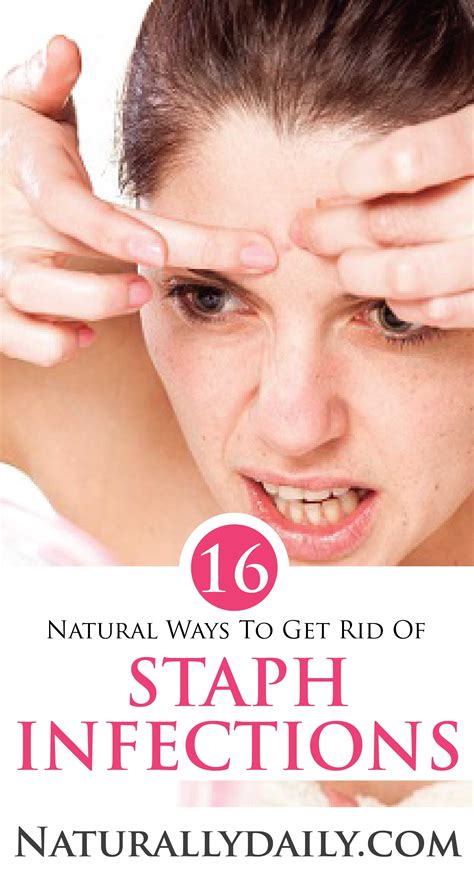 16 Natural Ways To Get Rid Of Staph Infections Staph Infection Skin