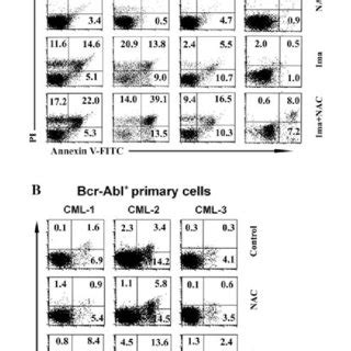 They stated that the incidence of nac necrosis depends on the length and the base width of the pedicle more than any. (PDF) N-acetyl cysteine enhances imatinib-induced ...