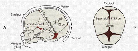 Diameters Of The Fetal Head At Term A Cephalic Presentations Occiput
