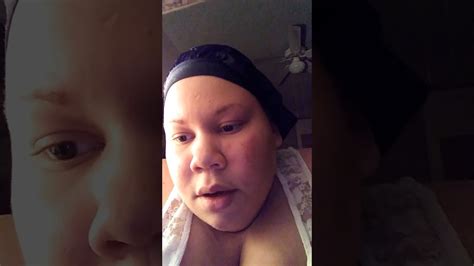 This group will (hopefully) provide support to gs patients who are at or near goal and working on the lifelong project of maintaining. Surgery process(gastric sleeve/gallbladder removal) - YouTube