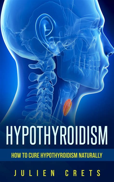 Read How To Treat Hypothyroidism Naturally Online By Julien Crets Sr