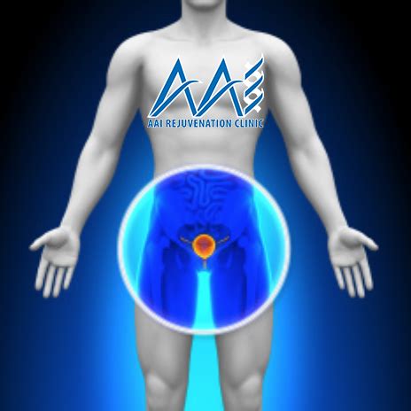 Testosterone Therapy And Prostate Cancer Aai Clinics