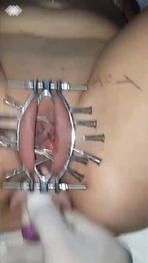 Anal Fisting With Needles In Her Pussy Masochist Enjoys A Lot