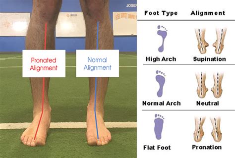 Corrective Exercise For Foot And Ankle