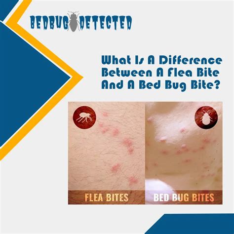 Flea Vs Bed Bug Bites Larablog