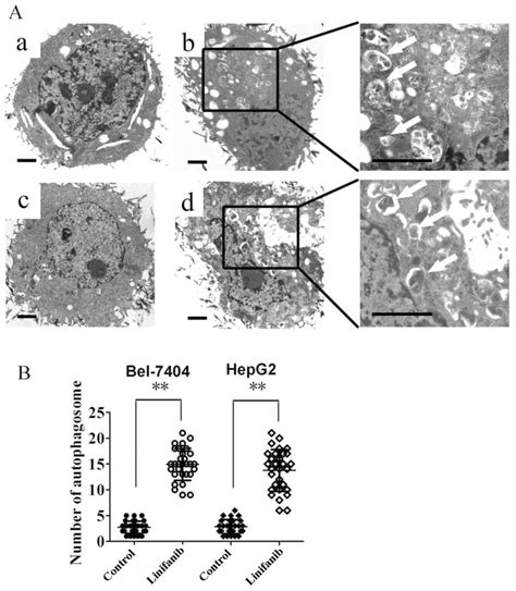Tem Depicting Ultrastructures Of Autophagosome In Cells Treated With