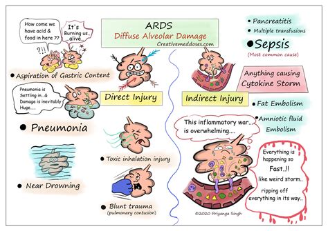 Acute Respiratory Distress Syndrome Ards Creative Med Doses
