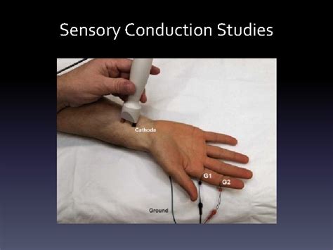 Basics Of Nerve Conduction Studies Review Diana Mnatsakanova