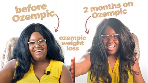 2 Months On Ozempic Weight Loss Before And After Side Effects