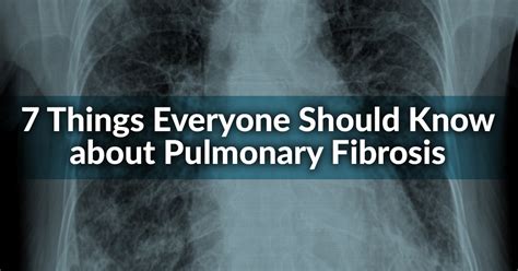7 Things Everyone Should Know About Pulmonary Fibrosis American Lung