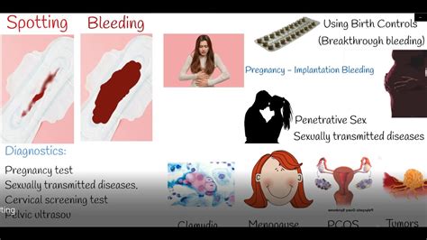 Spotting Vaginal Bleeding Between Periods Youtube