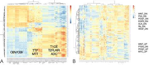 Figure 2 From Quantitative Radiomic Profiling Of Glioblastoma