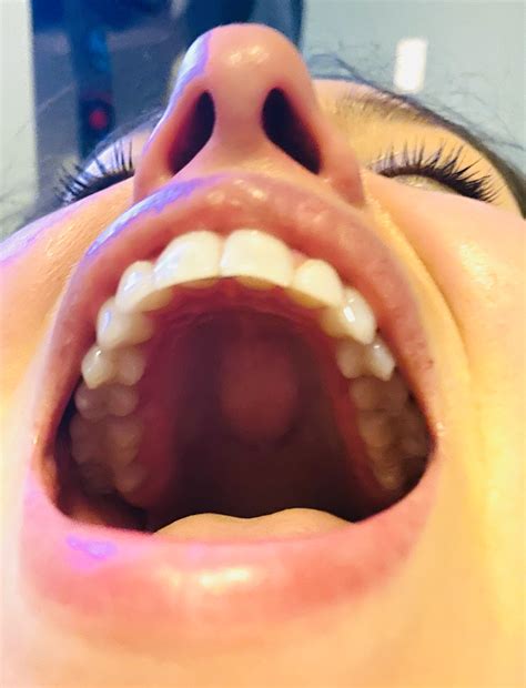 Your teeth help your tongue grind food as the tongue mixes the food around your mouth. A Small Percentage Of People Have A Bump On The Roof Of Their Mouths
