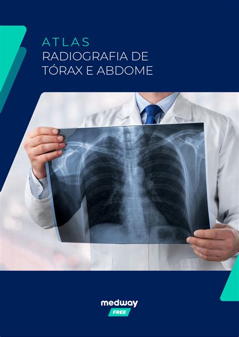Solution Radiografia Torax Abdome Interativo Studypool