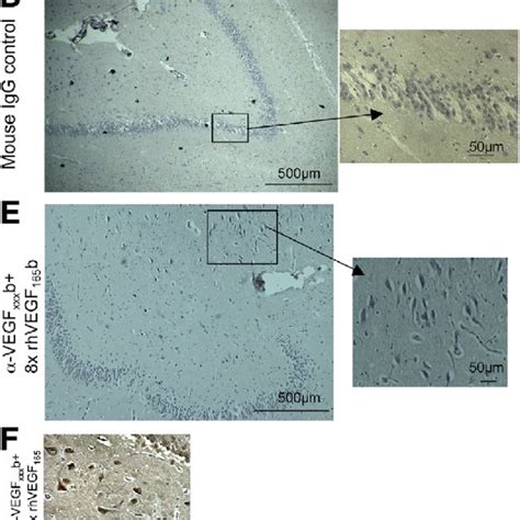 Vegf A 165 B Is Expressed In Human And Rat Hippocampus Human Cortical