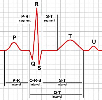 Read about the electrocardiogram (ecg, ekg) procedure used to reflect underlying heart conditions such as angina, occurrence of a prior heart attack or of an evolving heart attack, and more. 4:30-fart genom tillvaron: Arbets-EKG och ultraljud ...