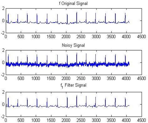 Figure From Analysis Of Ecg Signal Denoising Using Wavelet