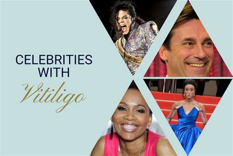 Famous Vitiligans 57 Celebrities With Vitiligo Unite For Vitiligo