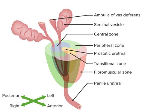 Benigne Prostatahyperplasie E Learning Mit Lecturio