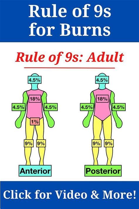 Rule Of 9s For Burns Medschool Doctor Medicalstudent Image Credits