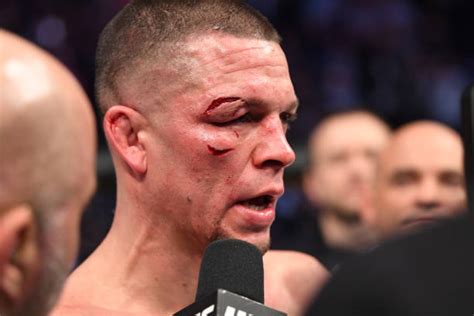 nate diaz net worth earnings age height girlfriend biography networth company