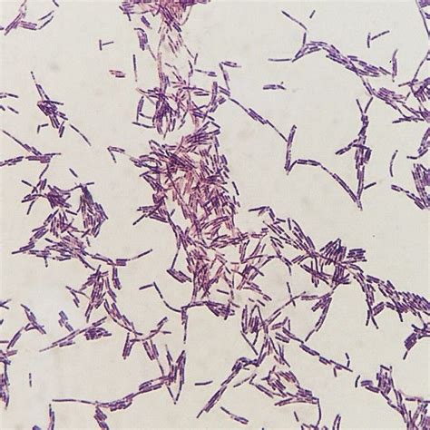 B cereus positive gram stain bacteria แบคทเรย Bacillus