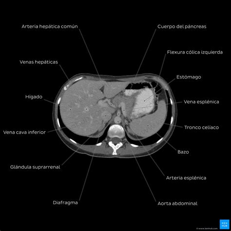 Anatomia Radiologica Del Abdomen The Best Porn Website