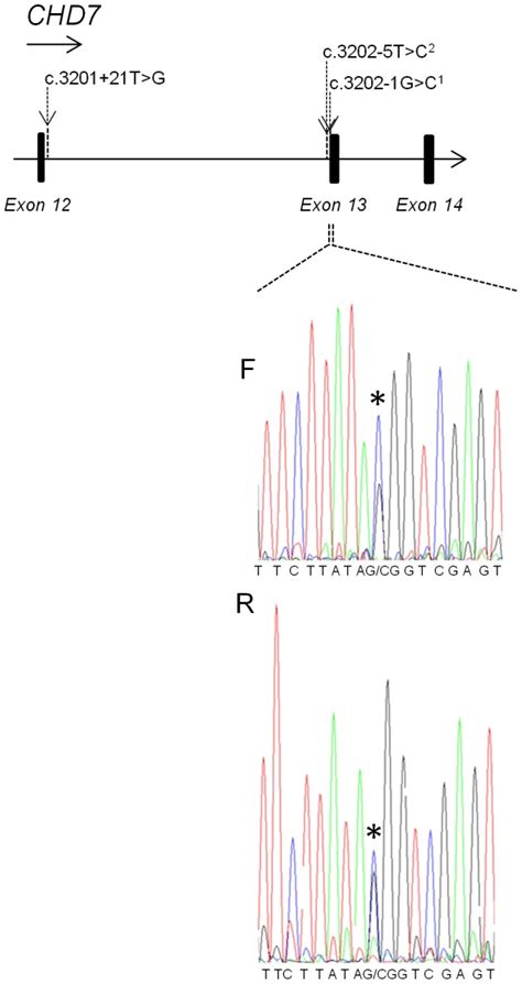 Upper Part Showing Single Base Mutations In Intron 12 Of The Chd7 Gene