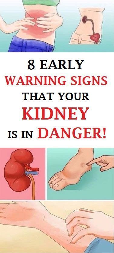 8 Early Warning Signs That Your Kidney Is In Danger With Images