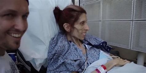 Rachael Farrokh Anorexia Recovery 40 Pound Woman In San Diego Hospital