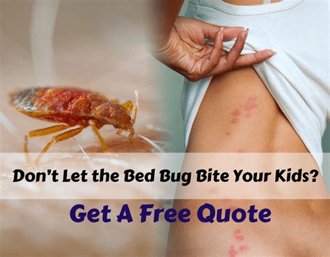 Dont Let The Bed Bug Bite Your Kids Call Exterminator In Surrey
