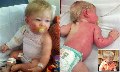 Arizona Boy Suffers Second Degree Burns After Being Hit By Scalding Hot Water Daily Mail Online