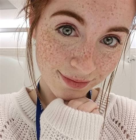 freckles freckles and freckles prettygirls