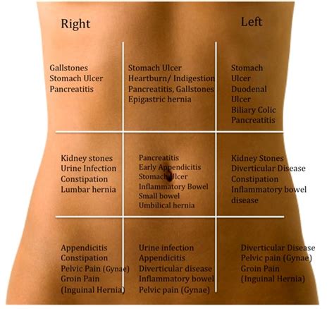 ‘belly Map That Is Explaining Your Stomach Pain Healthy Natural Solution
