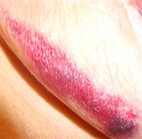 31 Days of “Little Known” FACTS — For Breast Cancer Awareness Month