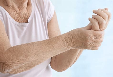 Sabes Diferenciar La Osteoartritis De La Artritis Reumatoide Vivir
