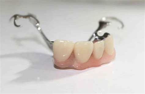 partial dentures in los algodones dental solutions algodones