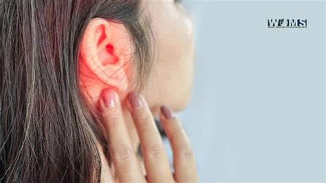 Common Causes Of Pain Behind Ears Conditions That Influence Pain Woms