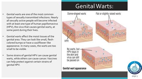 Ppt Genital Wart Causes Symptoms Prevention And Treatment Powerpoint Presentation Id 10132351