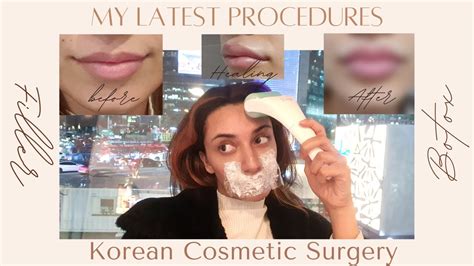 Korean Cosmetic Surgery Onul Plastic Surgery Gangnam YouTube